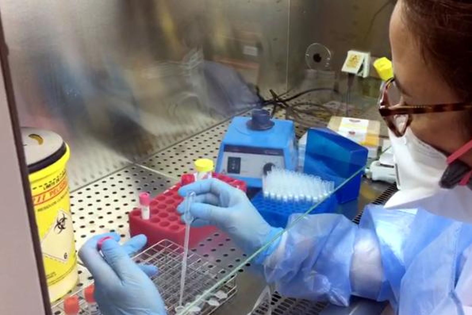 Análisis de muestras en el servicio de Microbiología del Hospital de Valme.