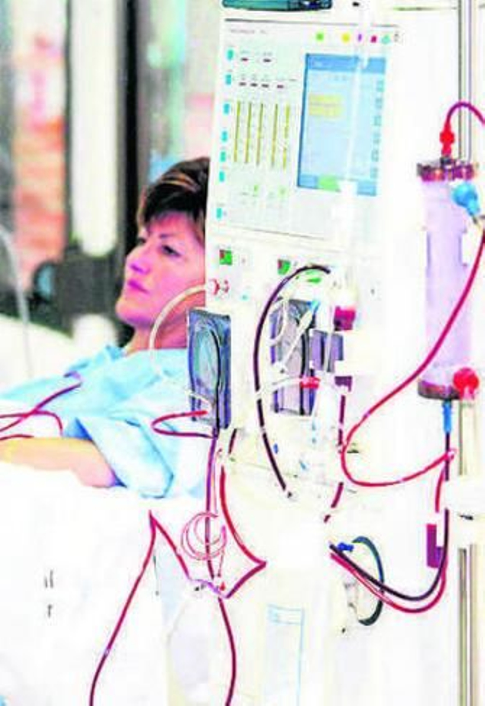 Una mujer en sesión de diálisis.