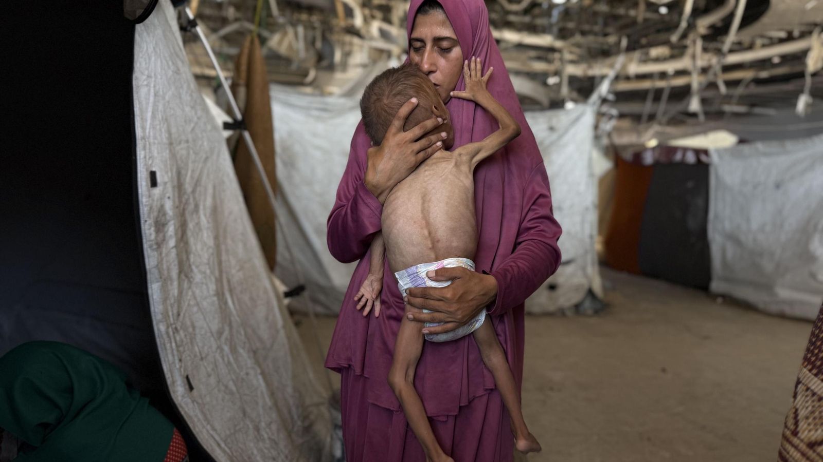 La desnutrición mata a cinco personas, incluido un bebe, en las últimas 24 horas en Gaza La desnutrición mata a cinco personas, incluido un bebe, en las últimas 24 horas en Gaza