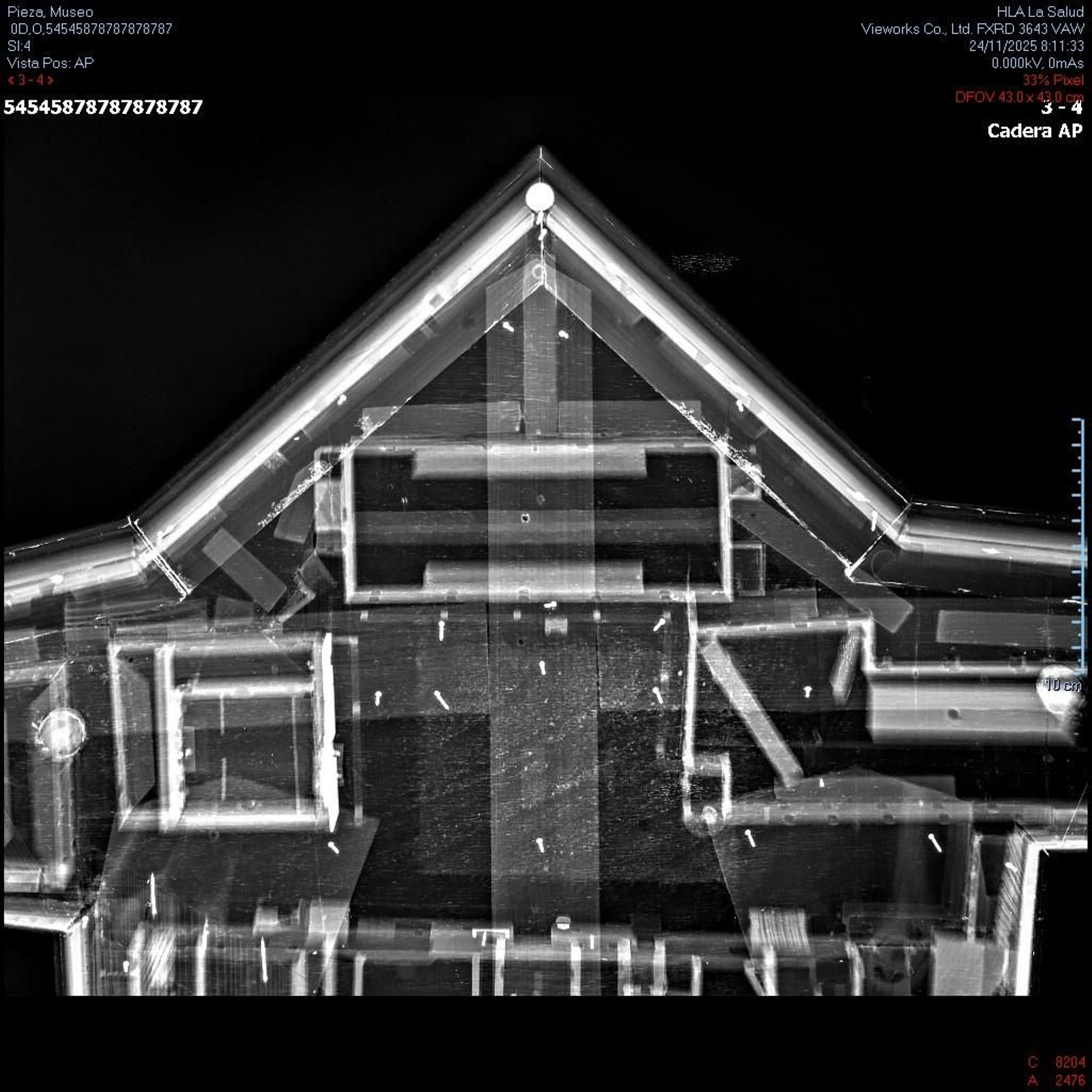 Radiografía de la pieza del Hospicio de la Maqueta de Cádiz.