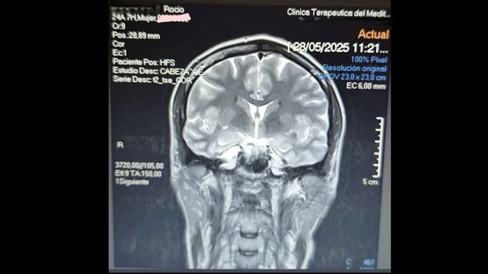 Una de las pruebas realizadas por la paciente que solicita colaboración económica