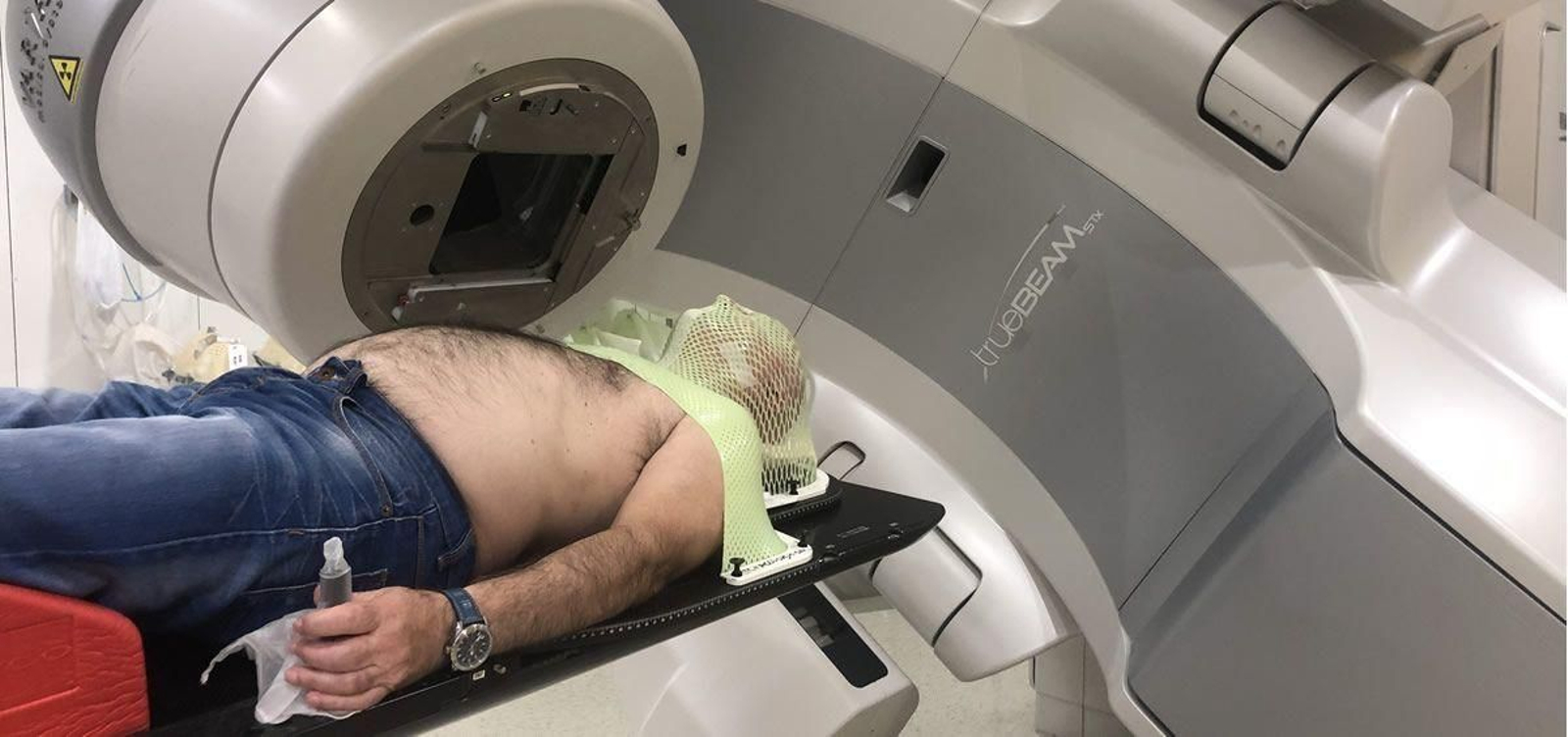 La radioterapia cura entre el 40% y el 90% de los tumores de cabeza y cuello