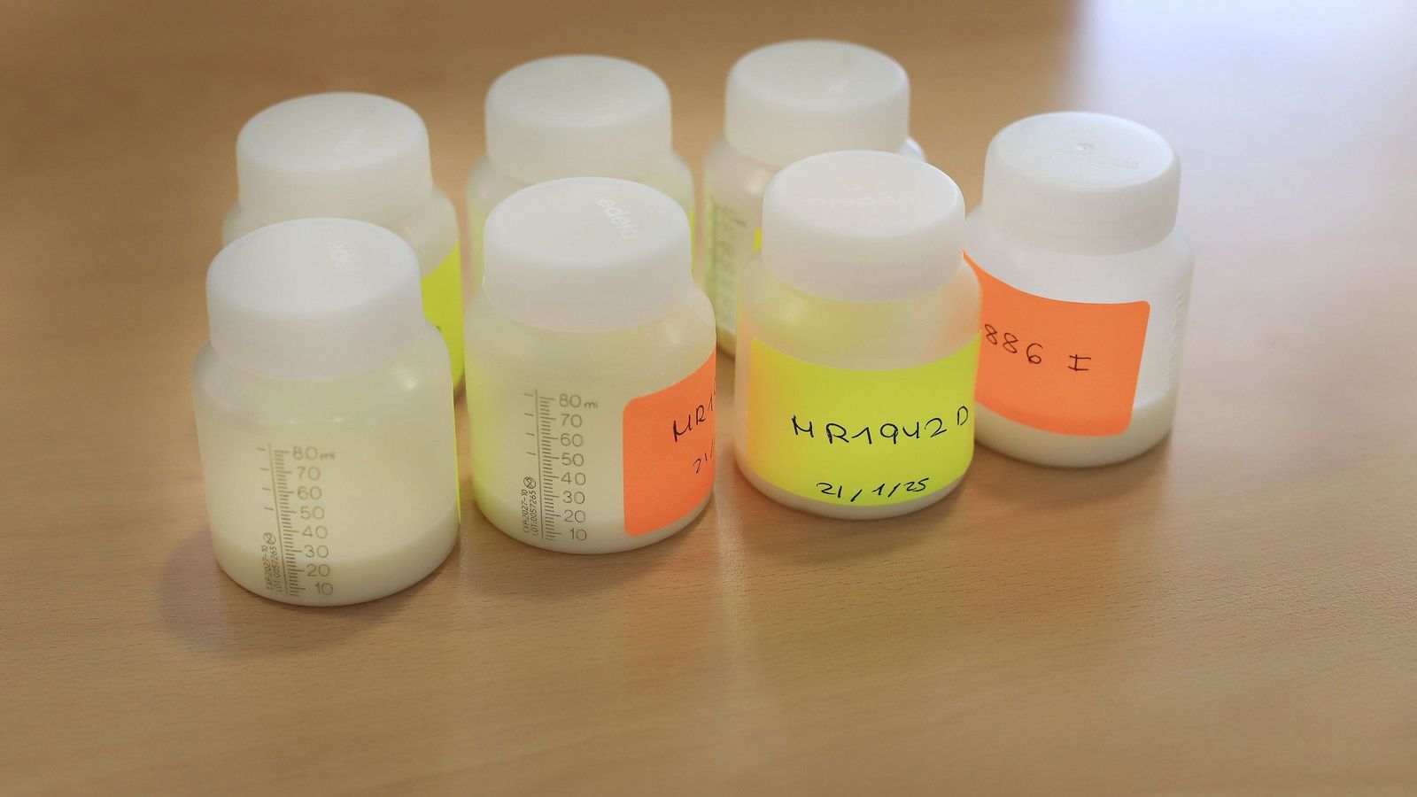 Muestras de leche materna recogidas en Jerez a principios de año.