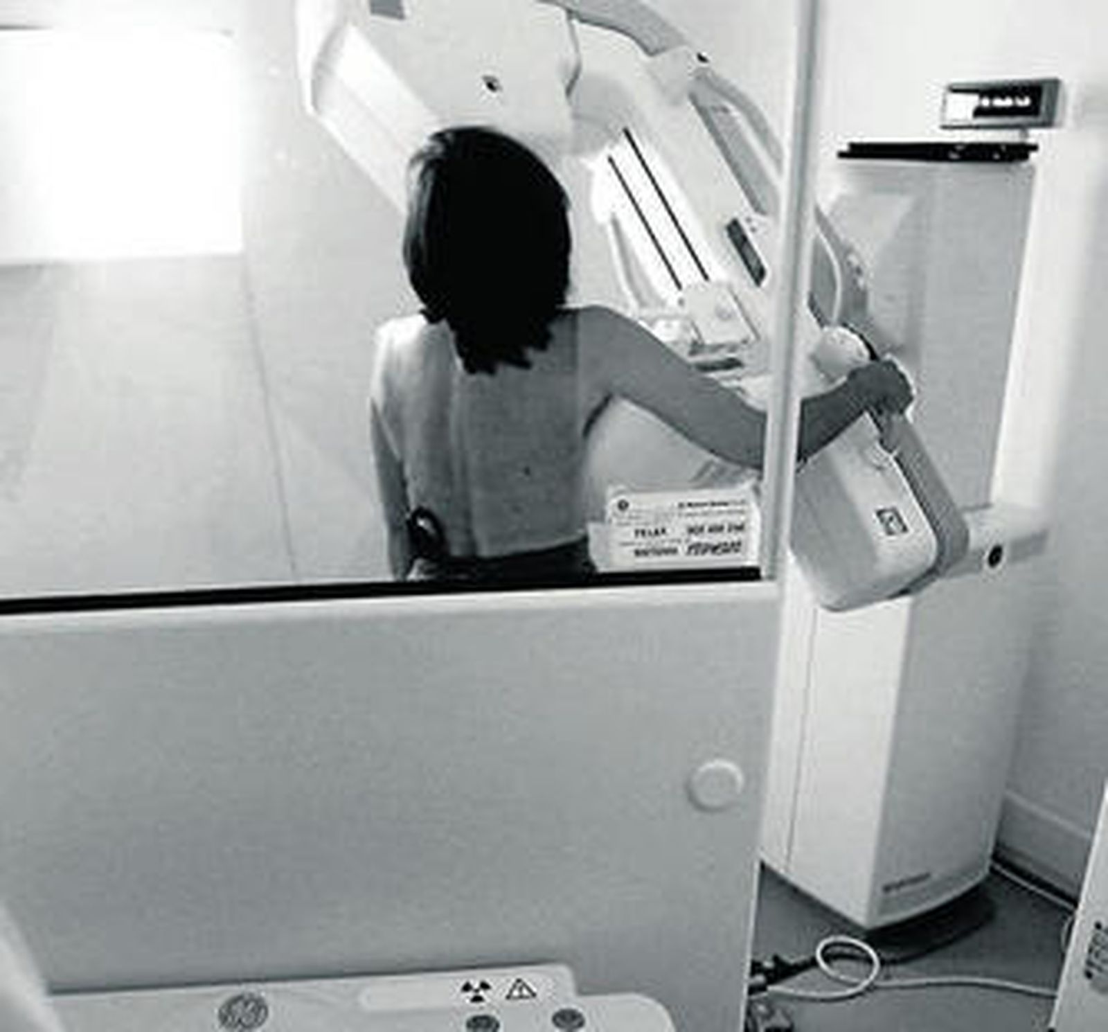 Una mujer se somete a una mamografía en la Unidad de Detección Precoz.