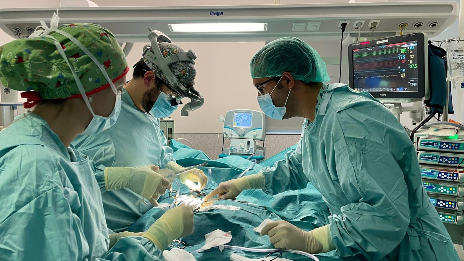 Otro momento de la intervención para que la circulación sanguínea pasara a ser extracorpórea. Otro momento de la intervención para que la circulación sanguínea pasara a ser extracorpórea.