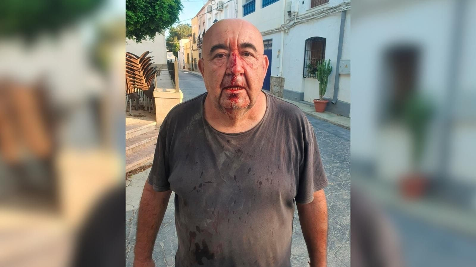 José Manuel Gil, concejal de Agricultura del Ayuntamiento de Alsodux, tras la agresión.