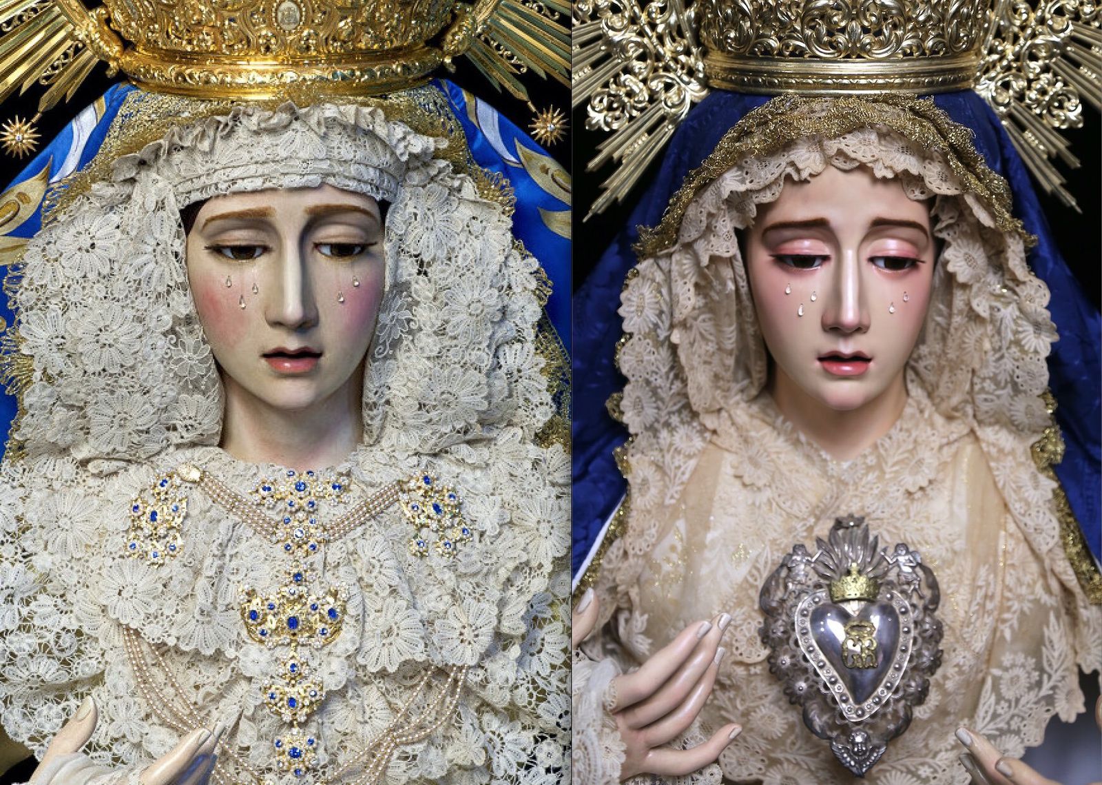 Comparativa del antes y el después de la imagen