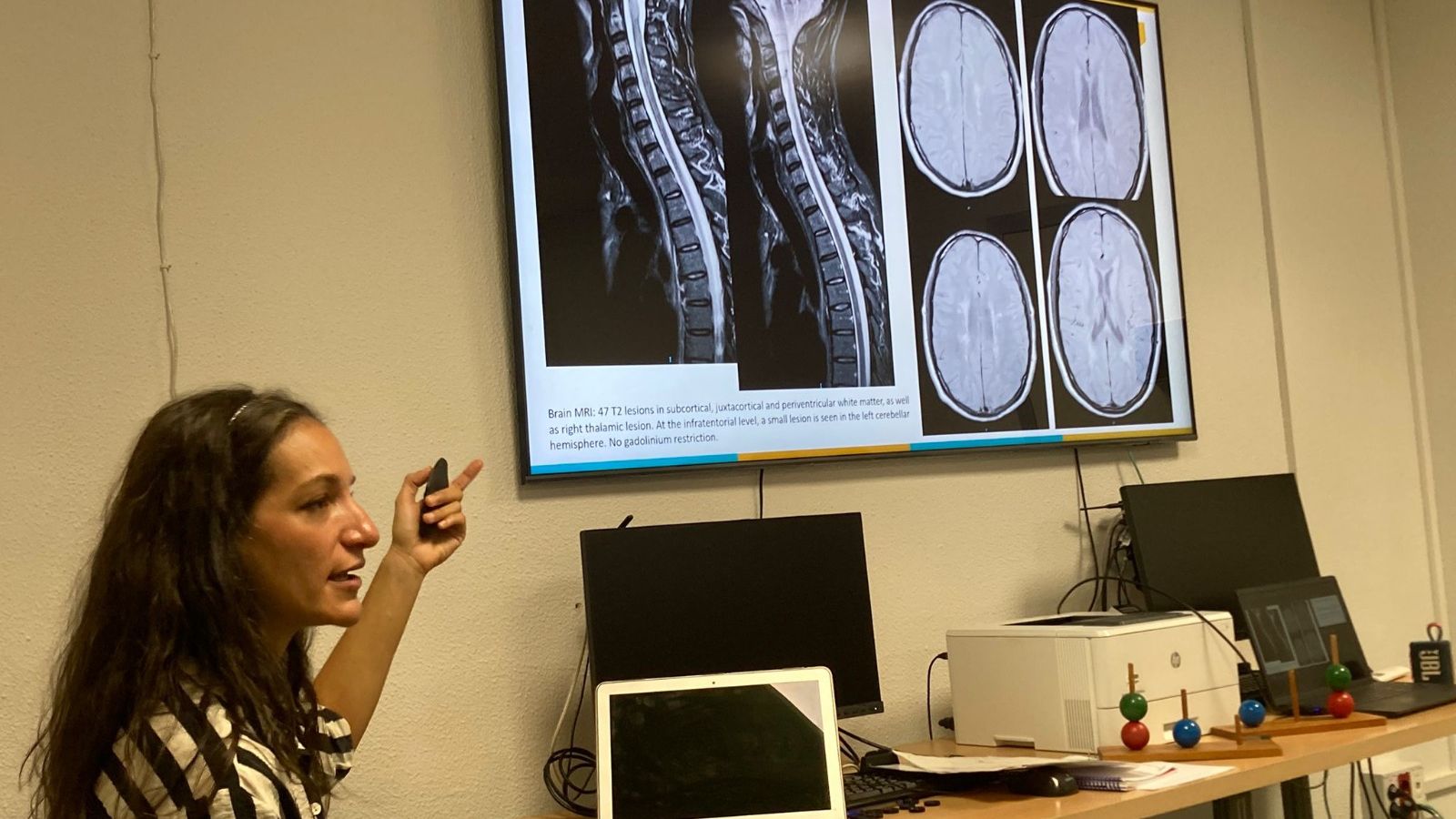 La directora de la unidad de Esclerosis Múltiple, Sara Eichau, durante una actividad de las jornadas.