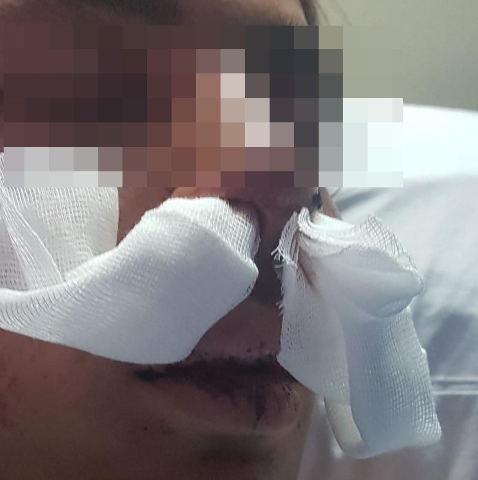 Estado del menor tras la paliza de unos policías en Melilla