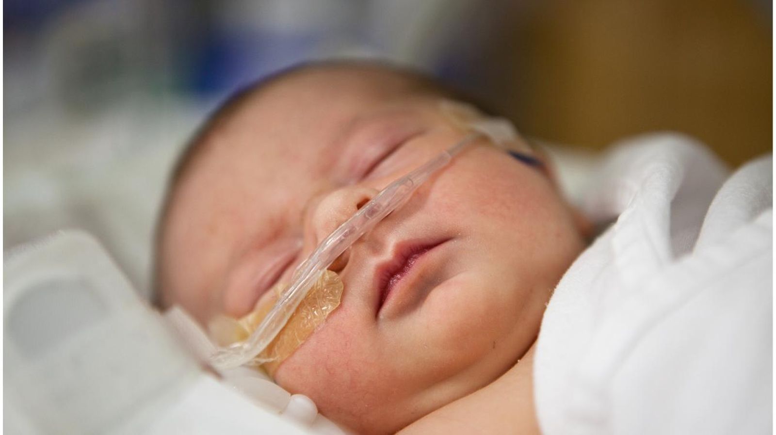 Imagen de un recién nacido con oxígeno