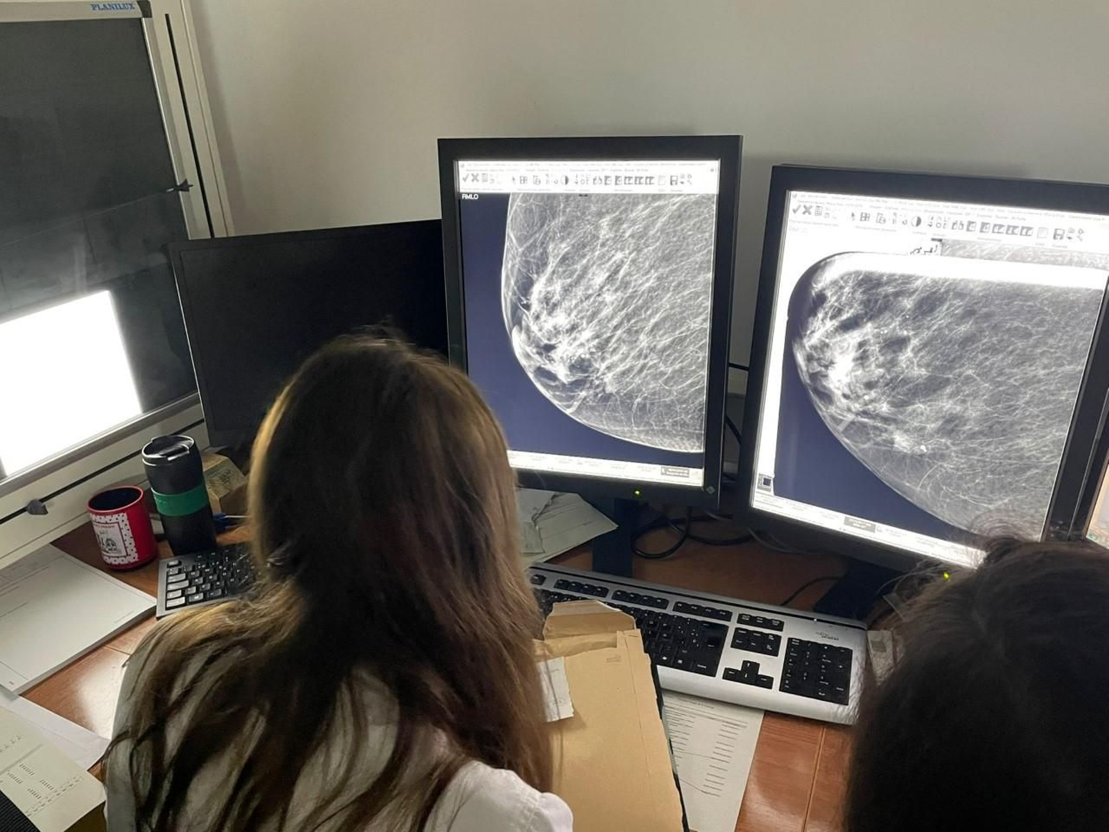 Una sanitaria analiza una mamografía.