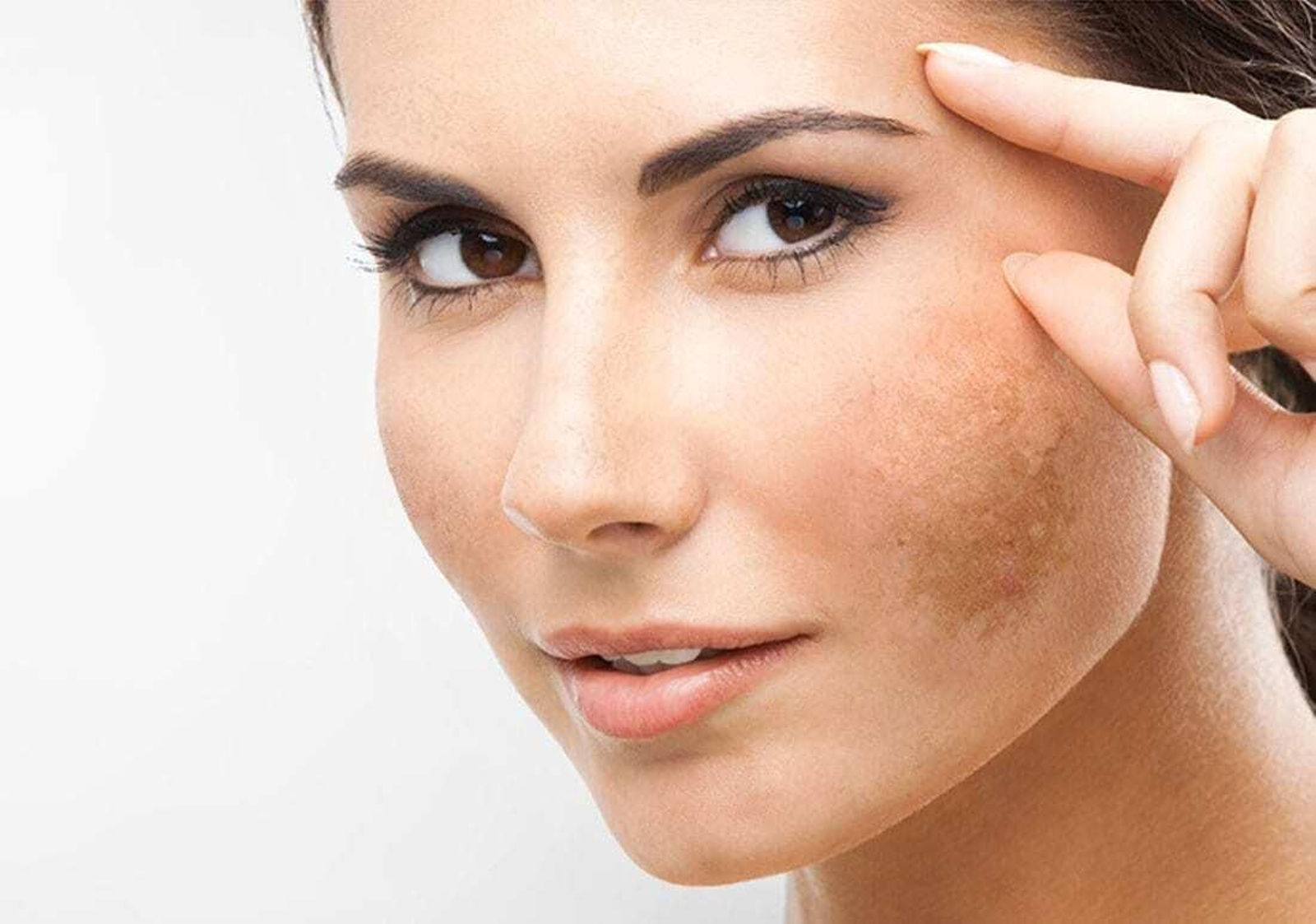 Esta es la crema anti-manchas más vendida de Amazon por tan sólo 10,47 euros Esta es la crema anti-manchas más vendida de Amazon por tan sólo 10,47 euros