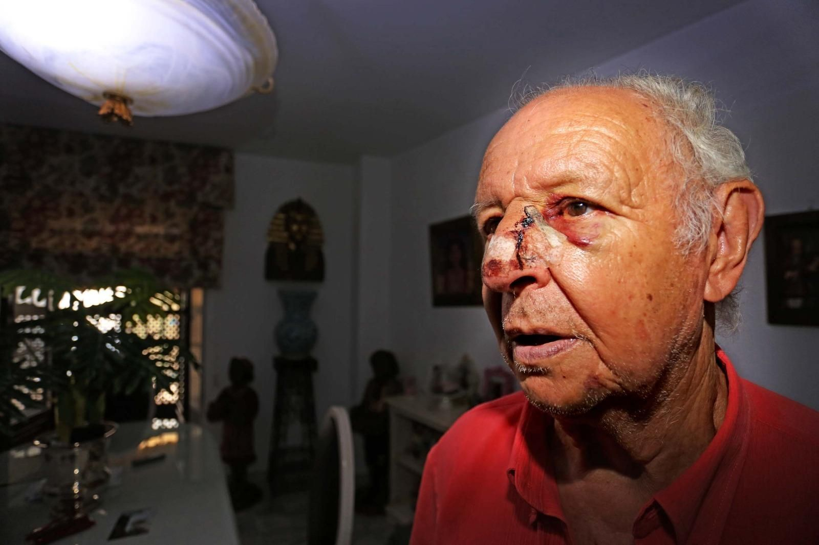 José Las Heras, con las graves heridas marcadas en el rostro.