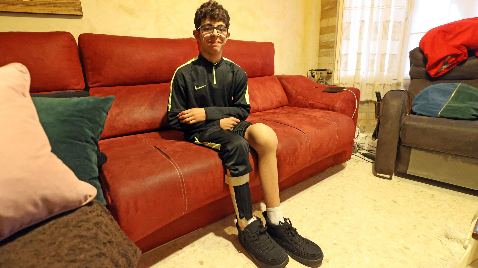 Hugo muestra sus piernas, una de ellas va con una férula y en la otra los huesos de su rodilla se han deformado.