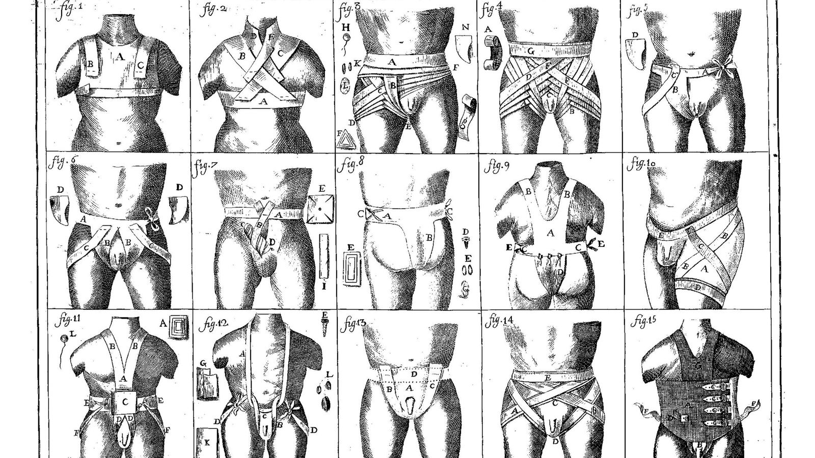Otra lámina del tratado de vendajes.
