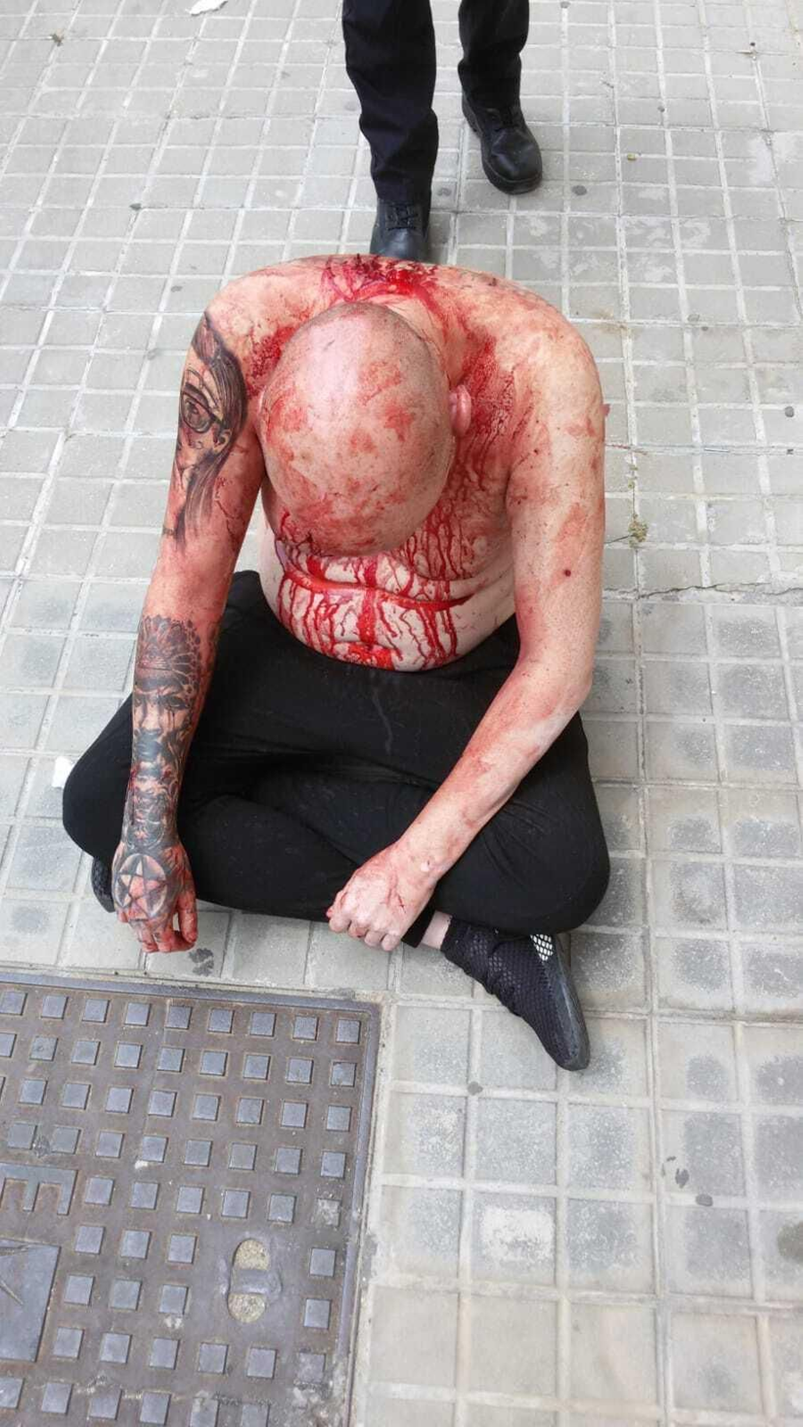 El herido, completamente cubierto de sangre.