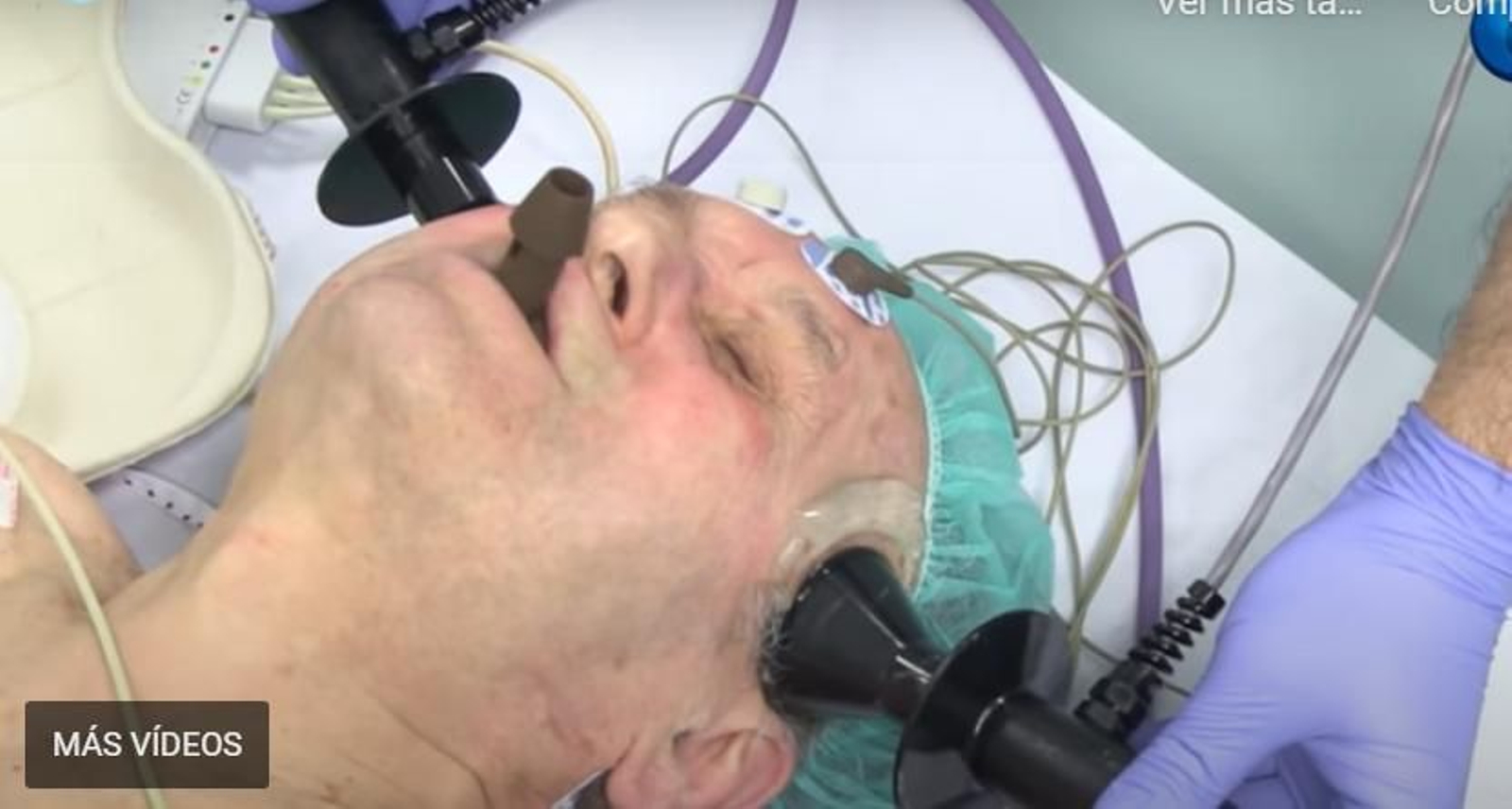 Descargas eléctricas como terapia para tratar la depresión severa