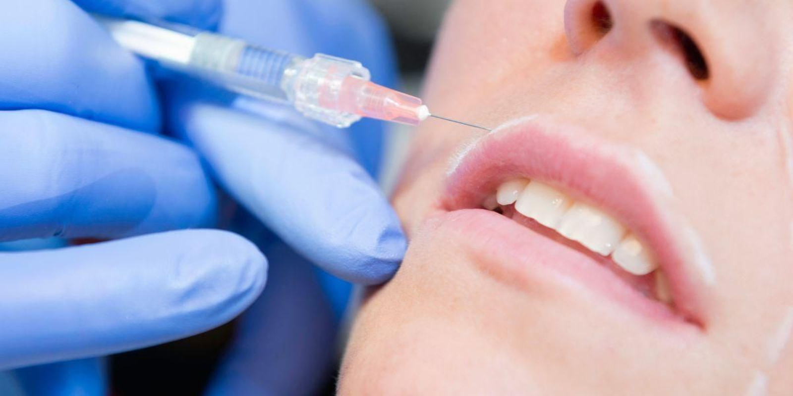 Retiran del mercado este famoso tratamiento estético de ácido hialurónico por peligros en su uso