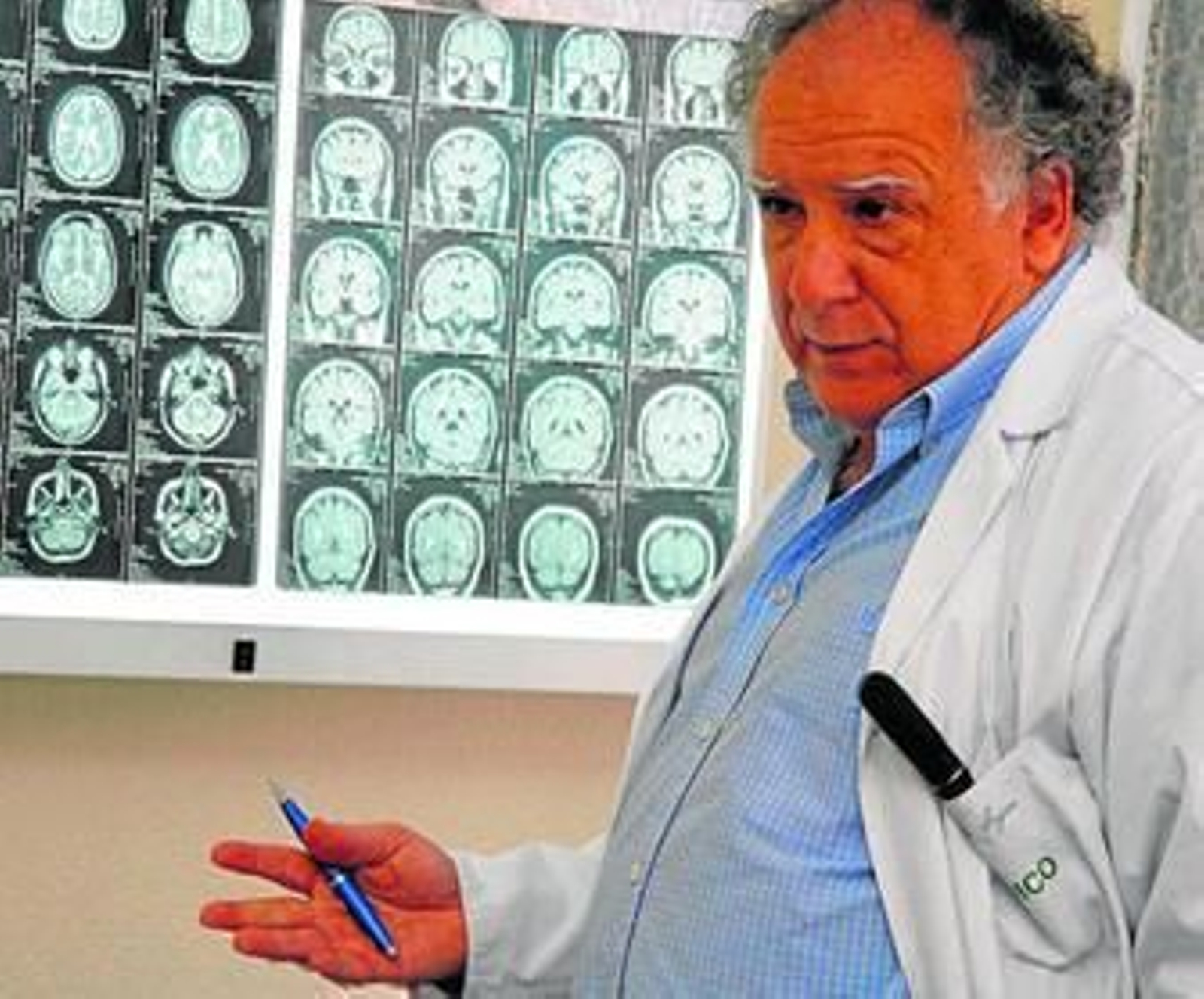 Guillermo Izquierdo, responsable de Neurología en el Hospital Virgen Macarena.