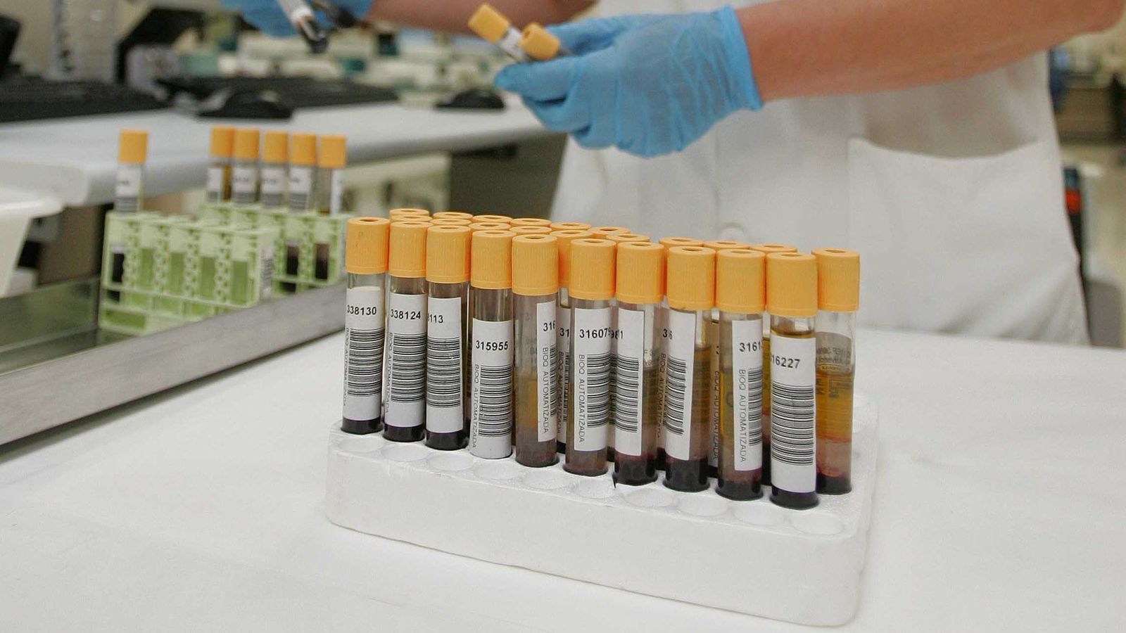 Pruebas diagnósticas en el laboratorio del Hospital de Torrecárdenas