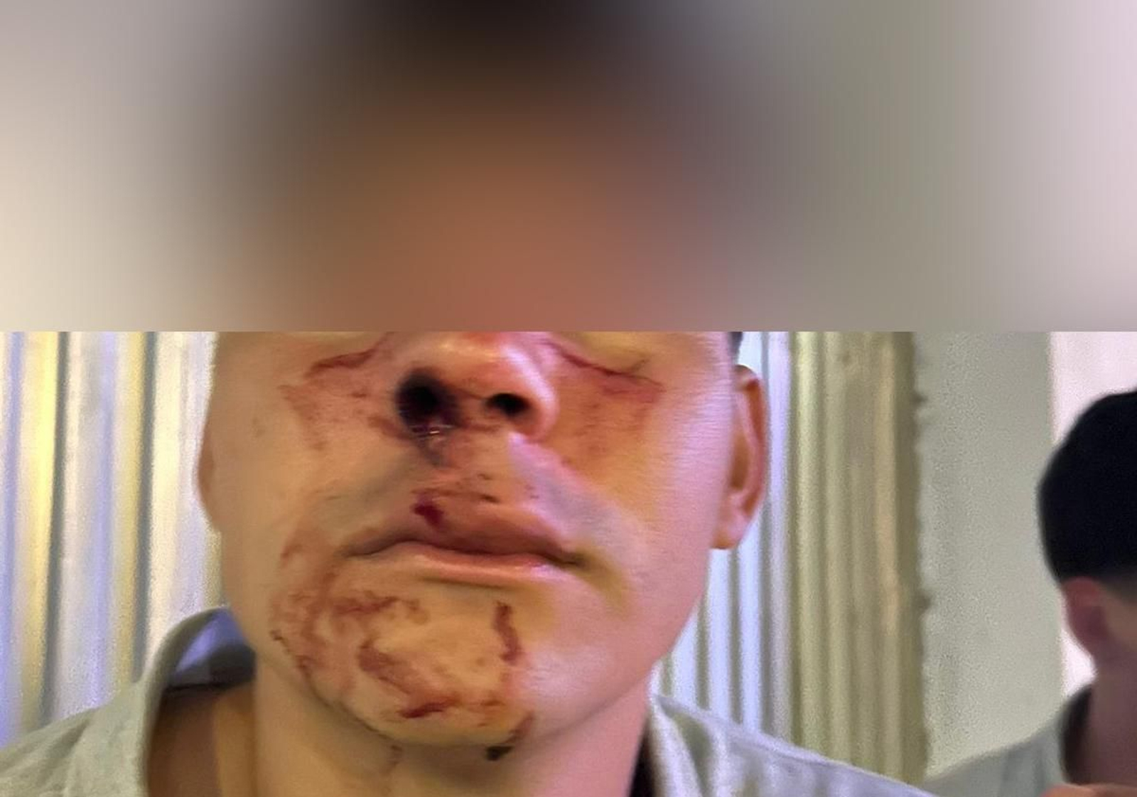 Heridas producidas por la agresión