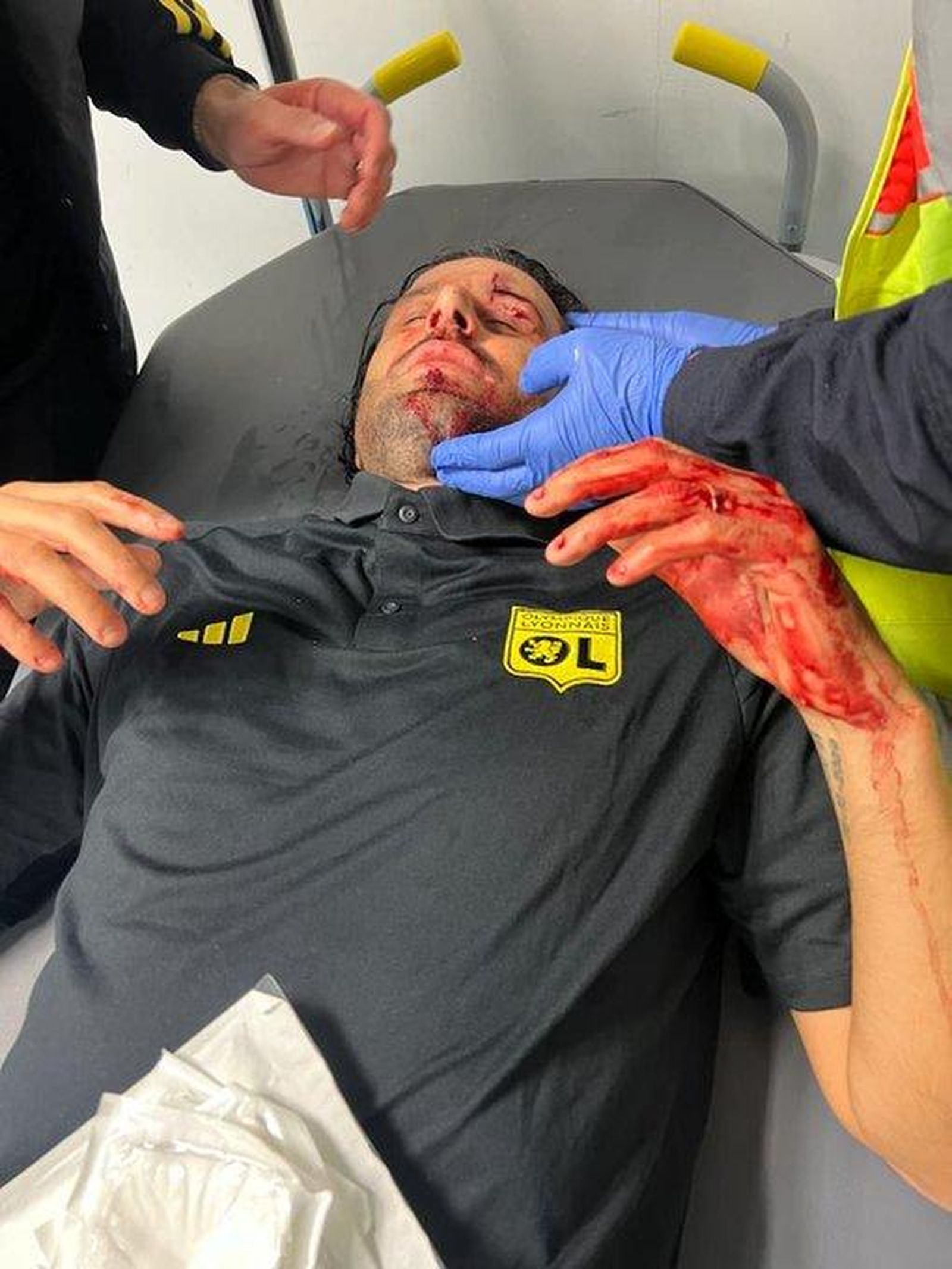 Fabio Grosso, atendido tras ser herido en la cara con los cristales rotos a pedradas.