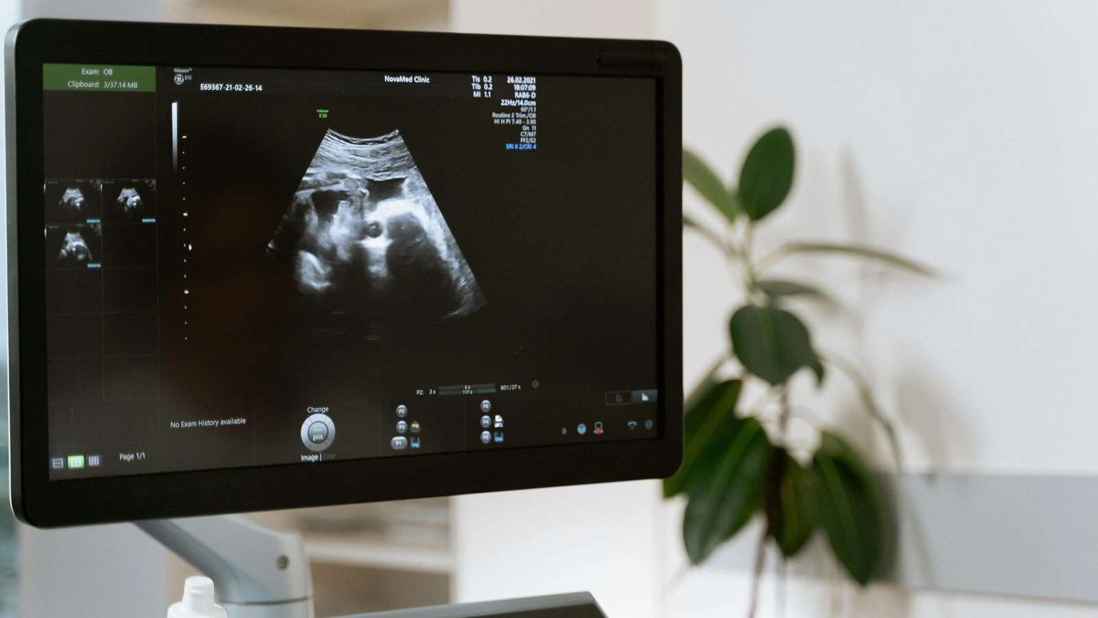 Pruebas de screening, diseñadas para evaluar el riesgo de que el feto desarrolle ciertas condiciones genéticas o anomalías Pruebas de screening, diseñadas para evaluar el riesgo de que el feto desarrolle ciertas condiciones genéticas o anomalías