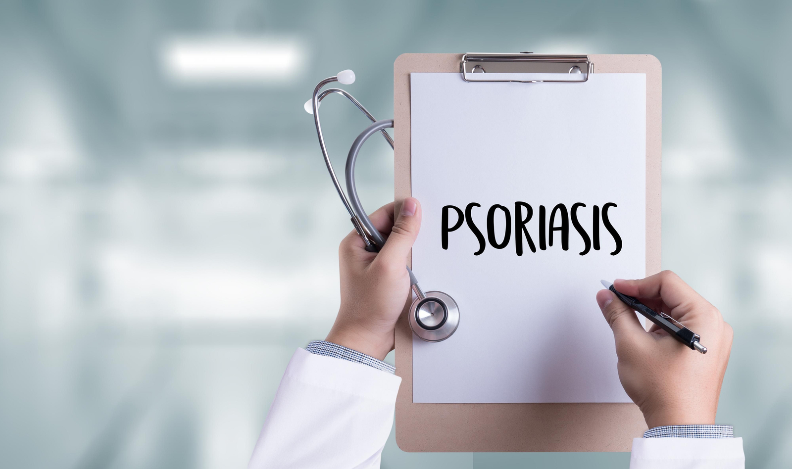 8 consejos para luchar contra la psoriasis