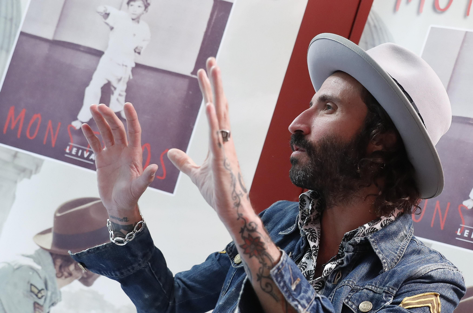 Leiva habla sobre el accidente que sufrió con 12 años.