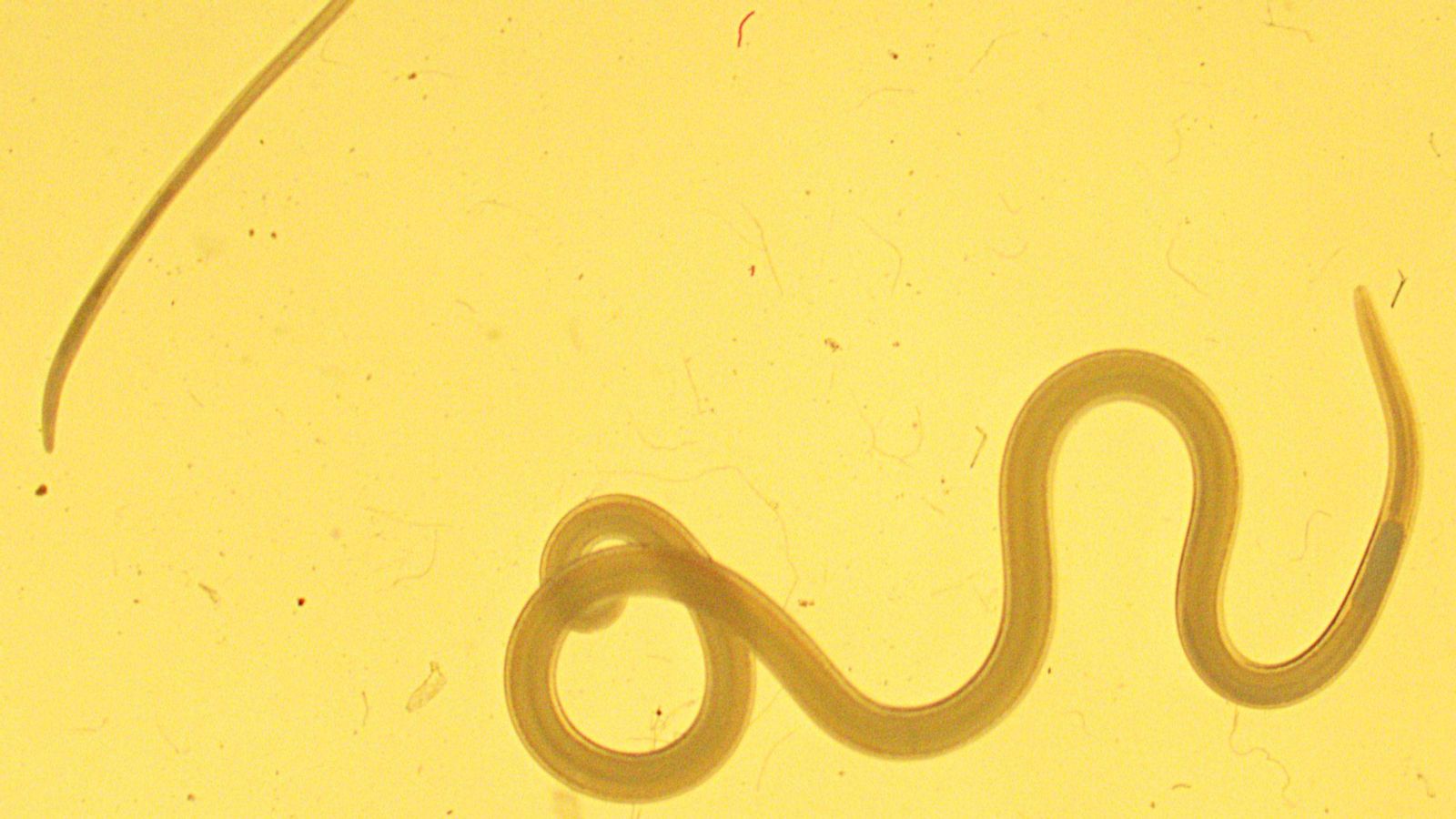 Larvas de Anisakis e Hysterothylacium Larvas de Anisakis e Hysterothylacium