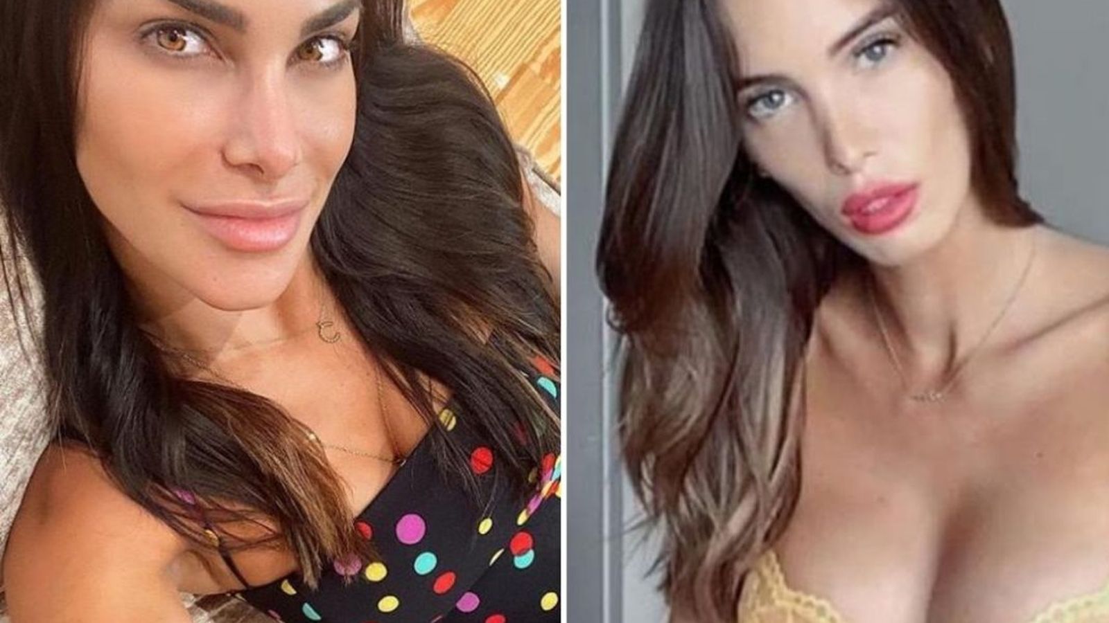 Antes y después del tratamiento de Marta López