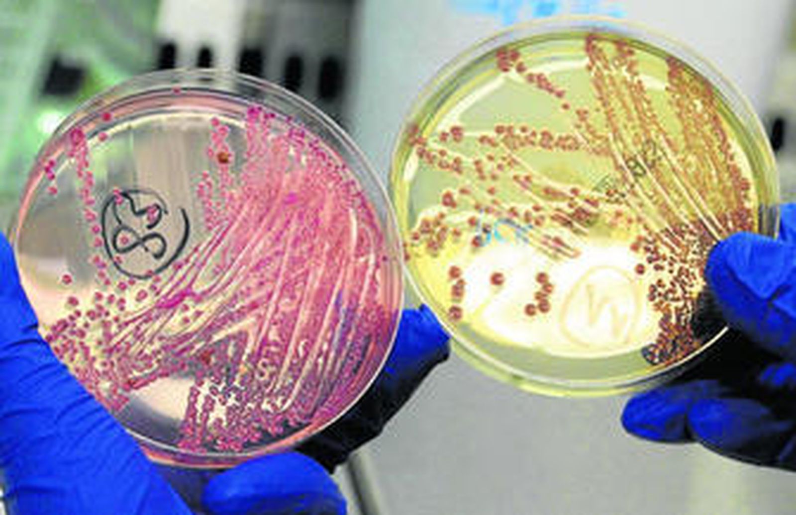 Los expertos trabajan por identificar tanto el origen de la bacteria como el foco de transmisión.