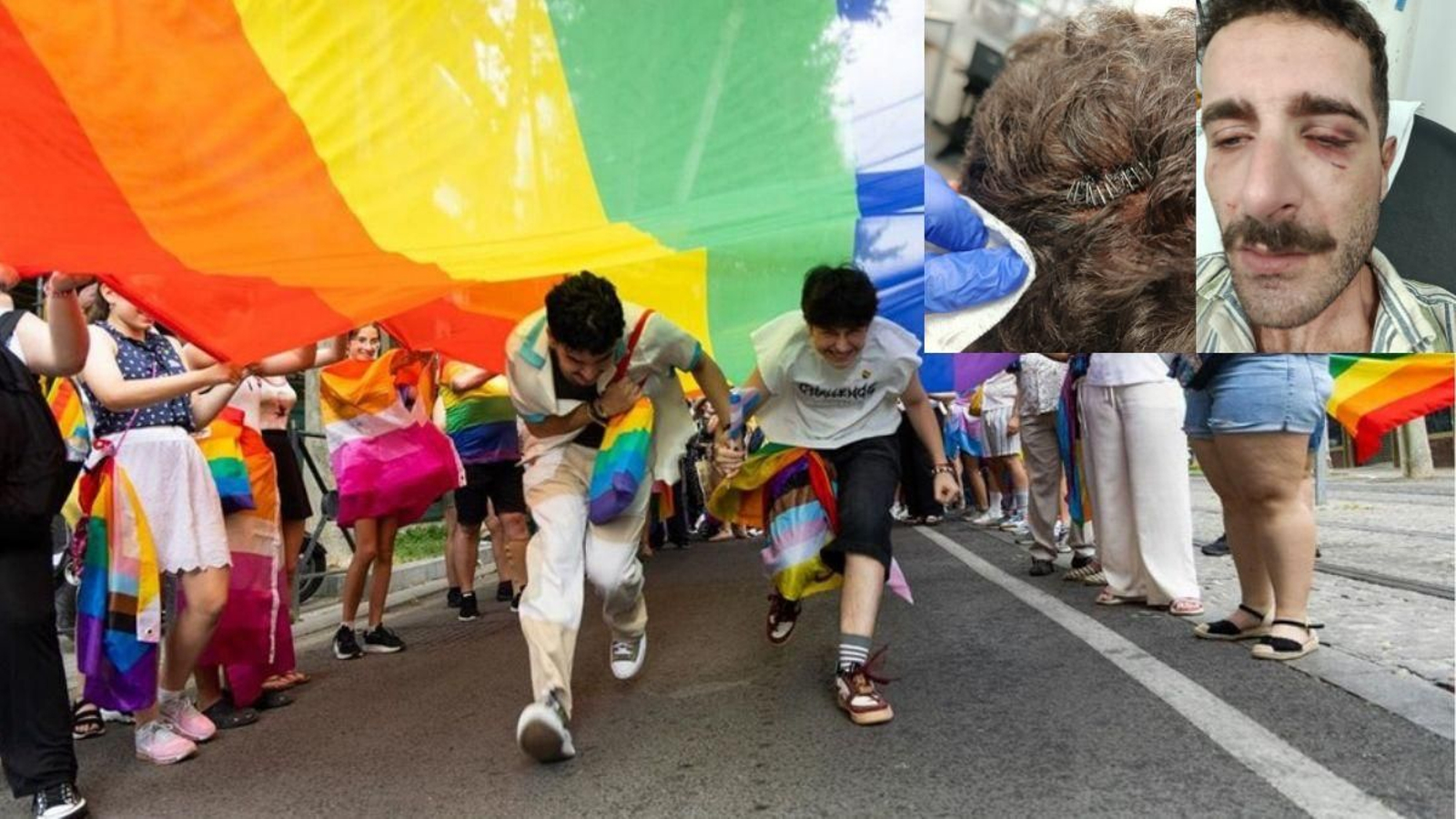 Imagen de archivo de la manifestación del orgullo del sábado junto a las lesiones de Juan Armenteros tras la agresión.