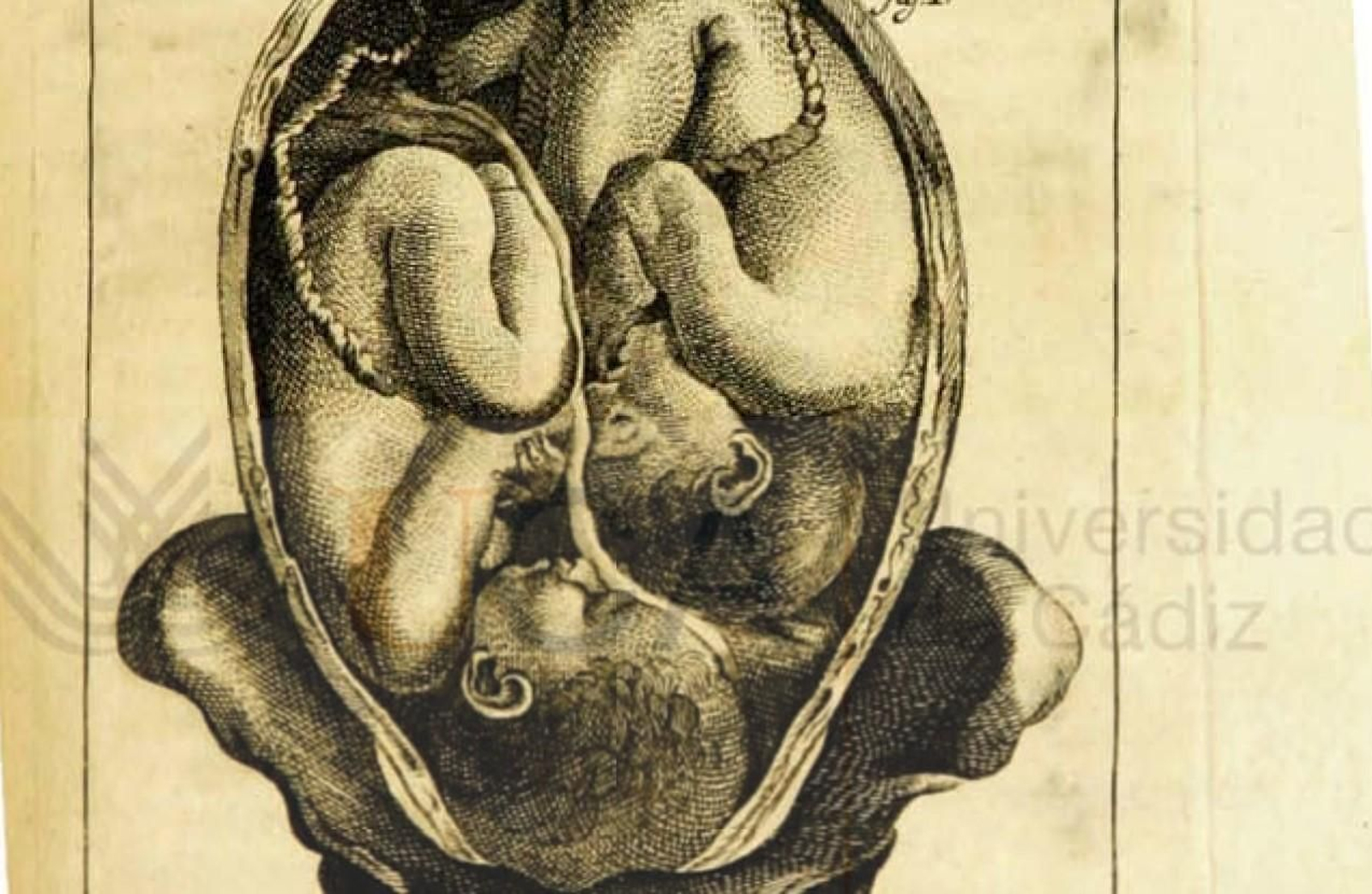 Detalle de una lámina de 'Elementos del arte de partear'. Don Juan de Navas. 1795.