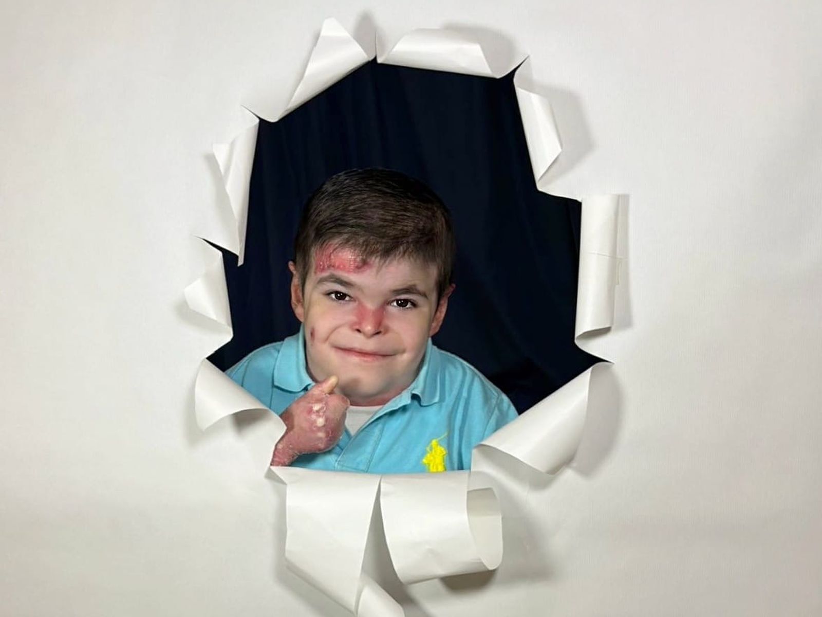 Leo, con 12 años, posa con una sonrisa mientras comparte su historia y su deseo de vivir sin dolor gracias al tratamiento que aún no llega a España
