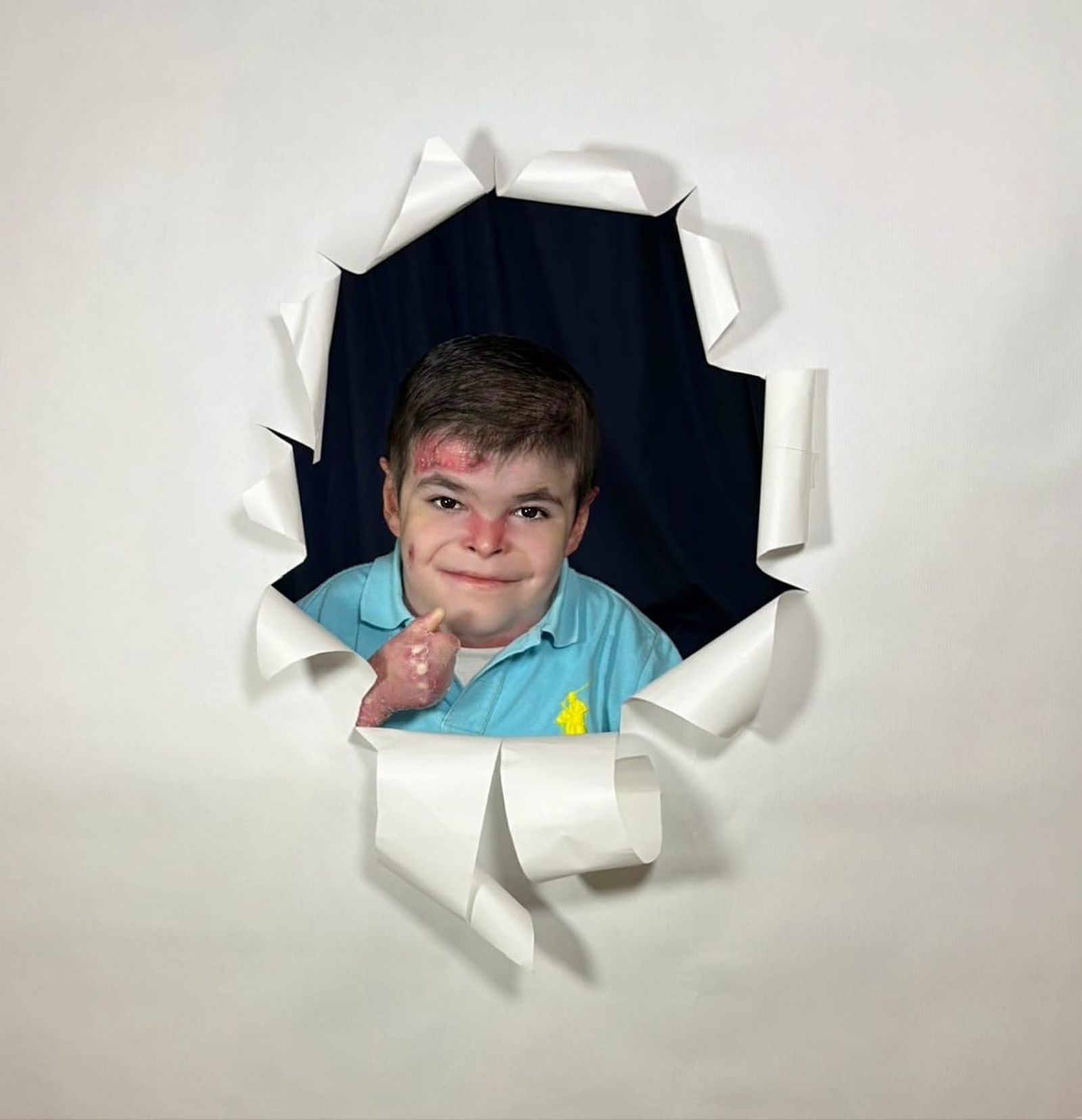 Leo, con 12 años, posa con una sonrisa mientras comparte su historia y su deseo de vivir sin dolor gracias al tratamiento que aún no llega a España