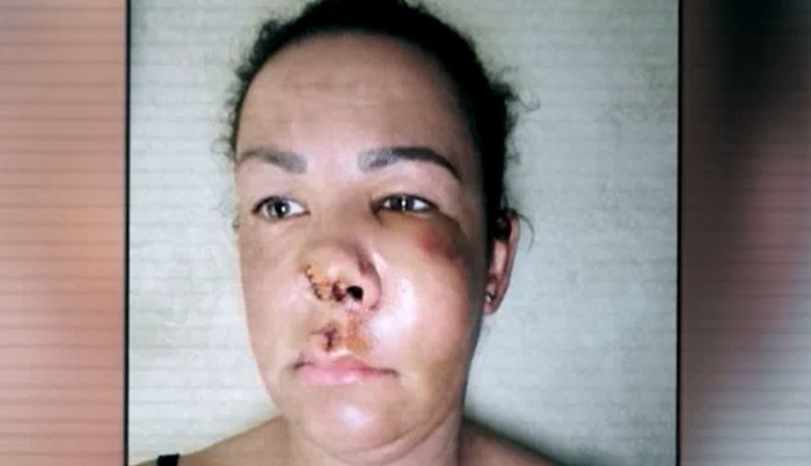 María del Mar, agredida en Zaragoza por el dueño de un perro