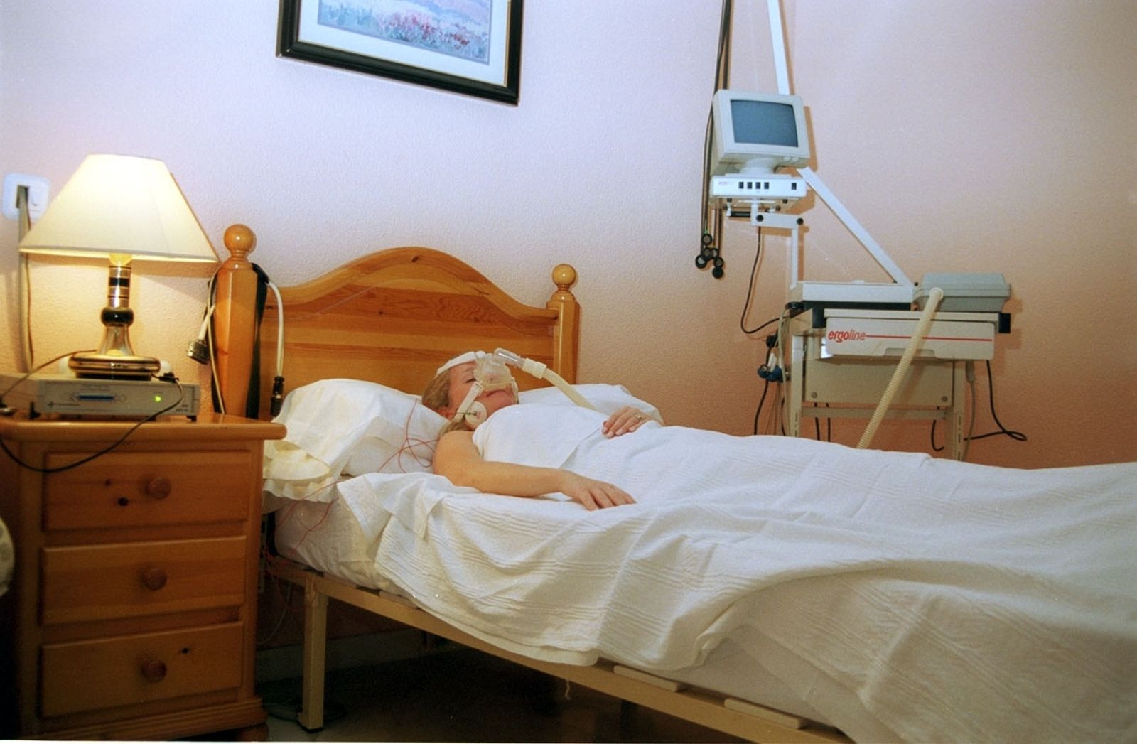 Una paciente afectada por apneas del sueño.