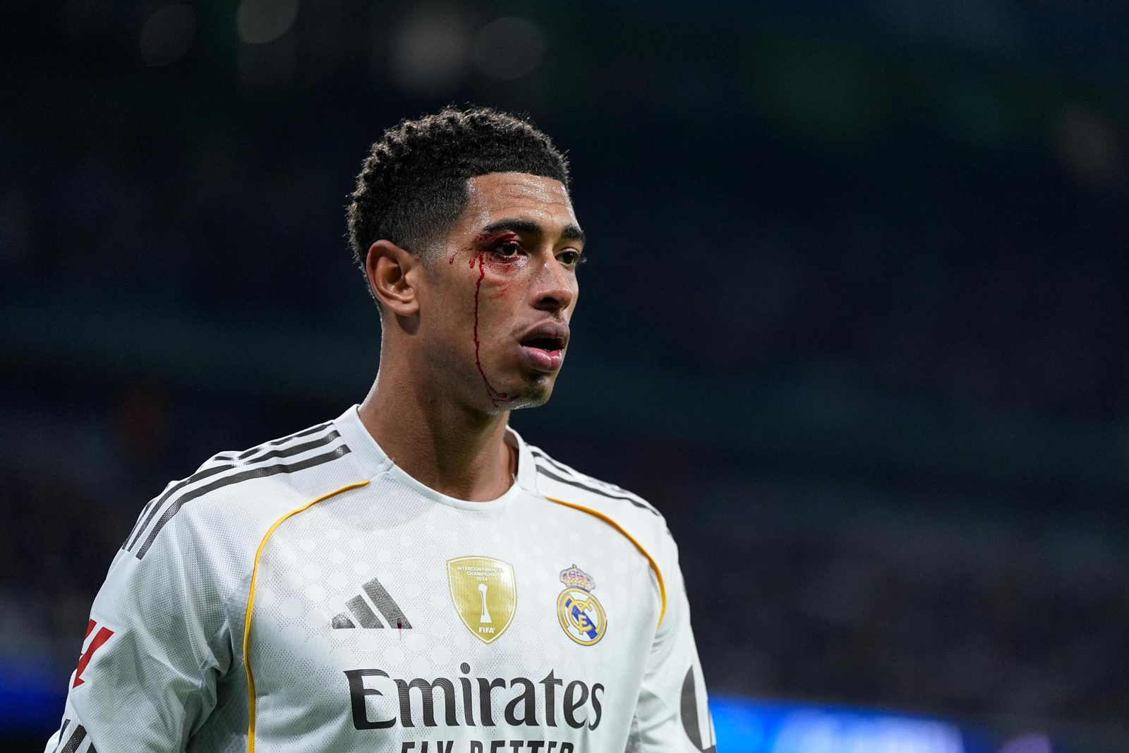 Las fotos de la derrota del Real Madrid contra el Celta