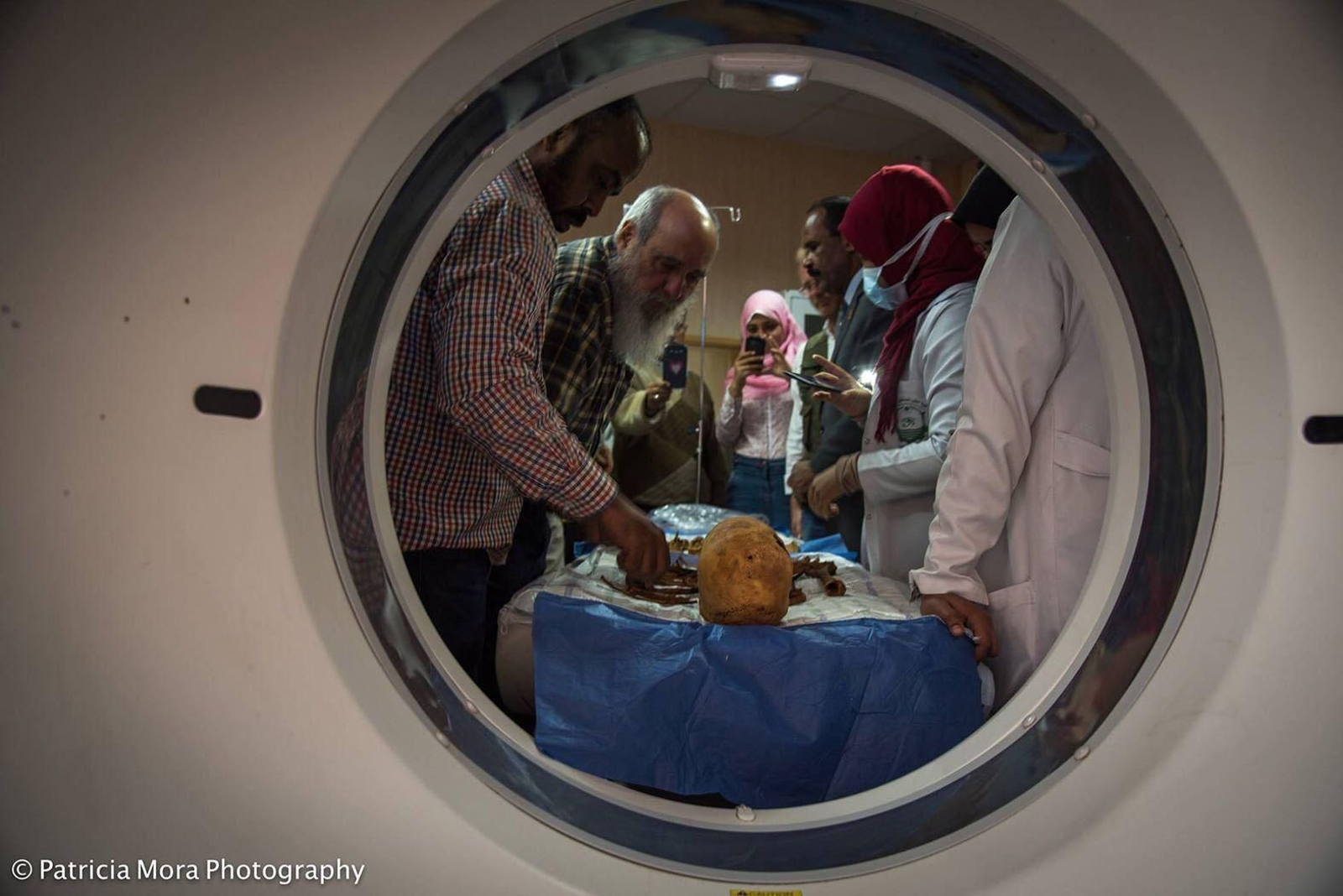 Las imágenes se obtuvieron en el hospital universitario de Asuán (Egipto) y también han colaborado en Granada el servicio de Radiodiagnóstico del hospital del PTS.