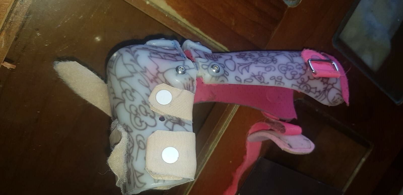 Una férula similar a ésta es la que perdió la hija de Fanny