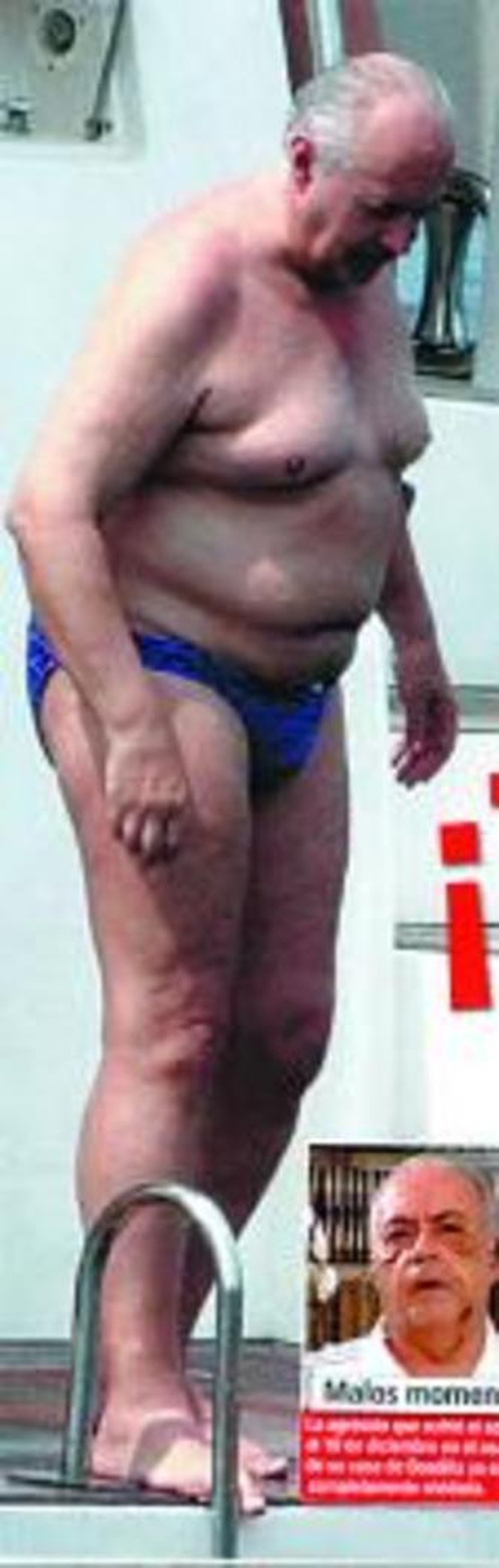 El verano destapa las carnes