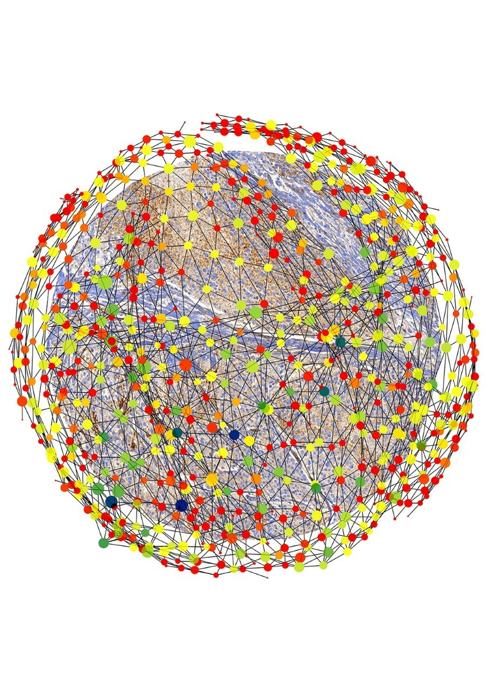 Matemáticas al servicio de la detección del cáncer.