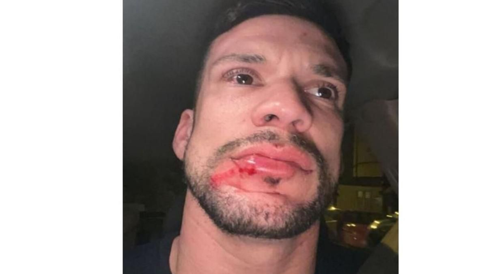 Imagen de la víctima de la agresión