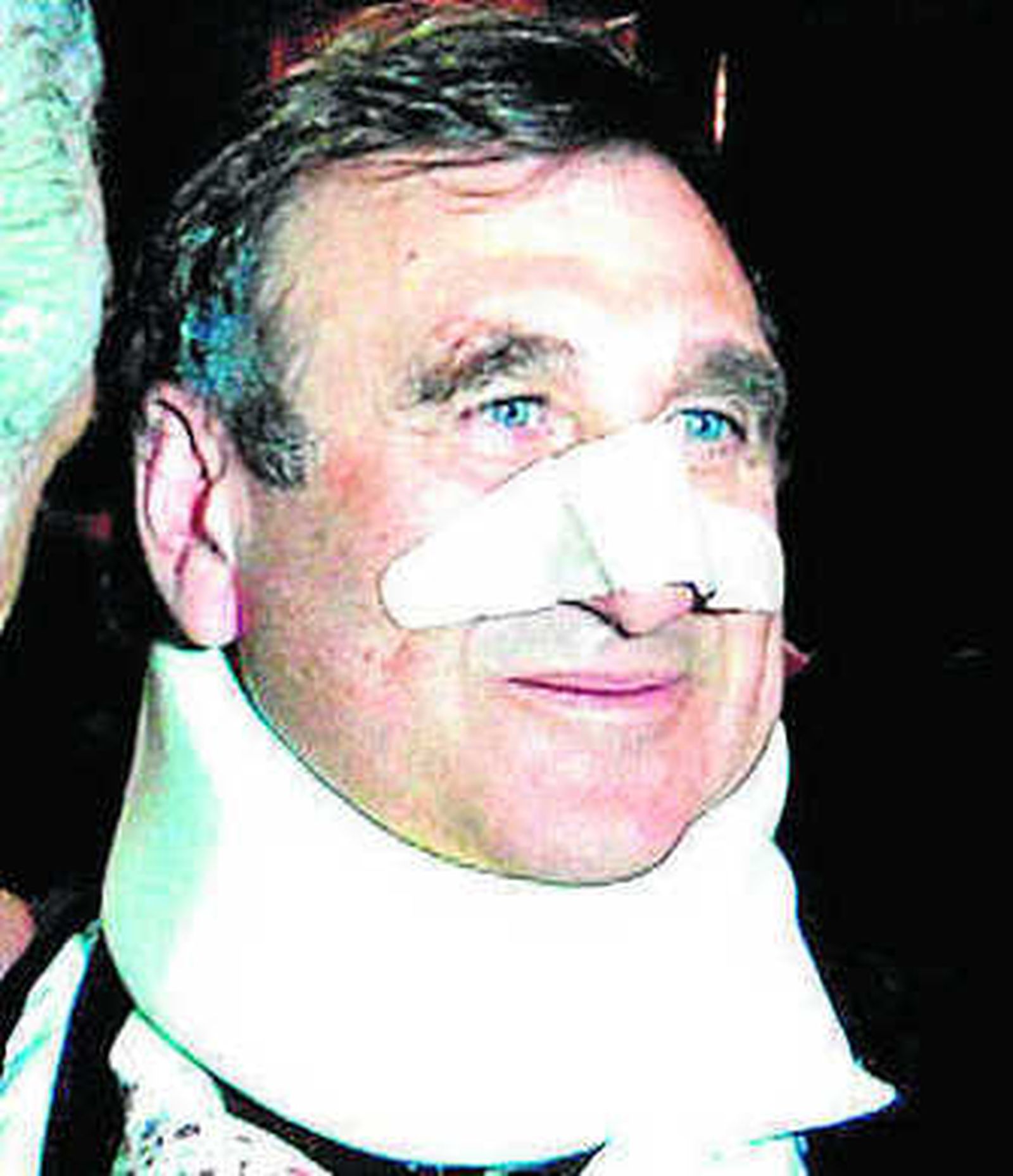 Asián "Uno de los puñetazos me impacta en la nariz y me deja K.O."