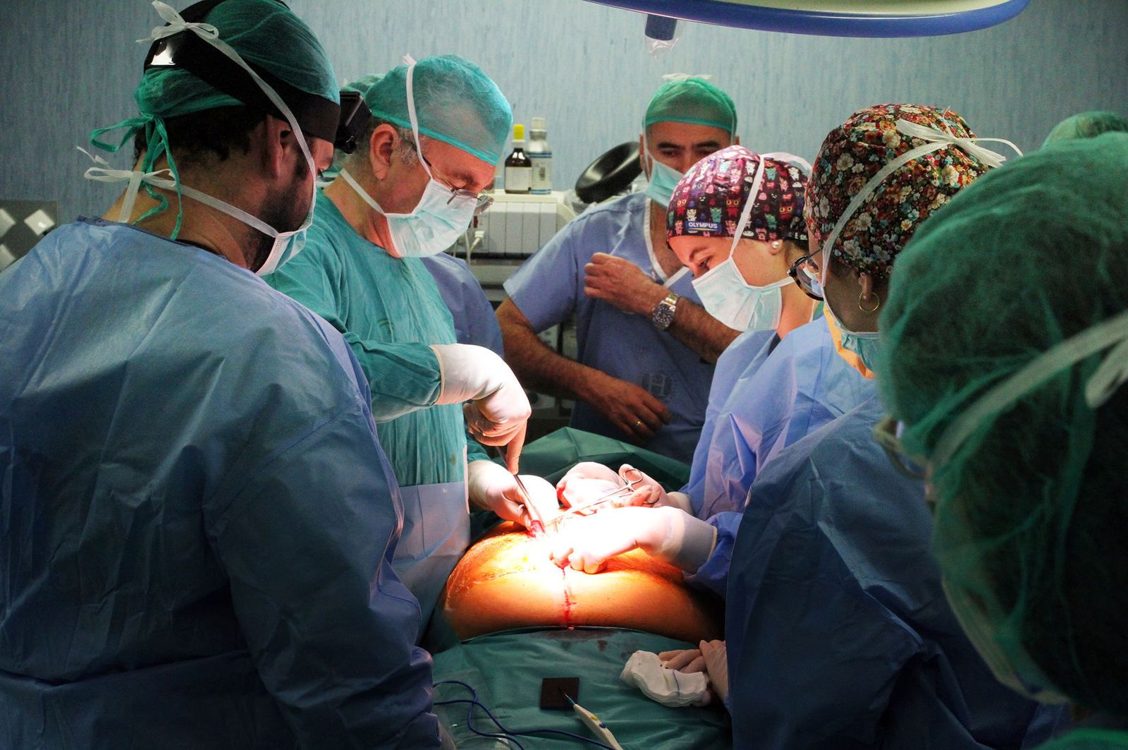 El equipo médico durante una intervención quirúrgica de una hernia
