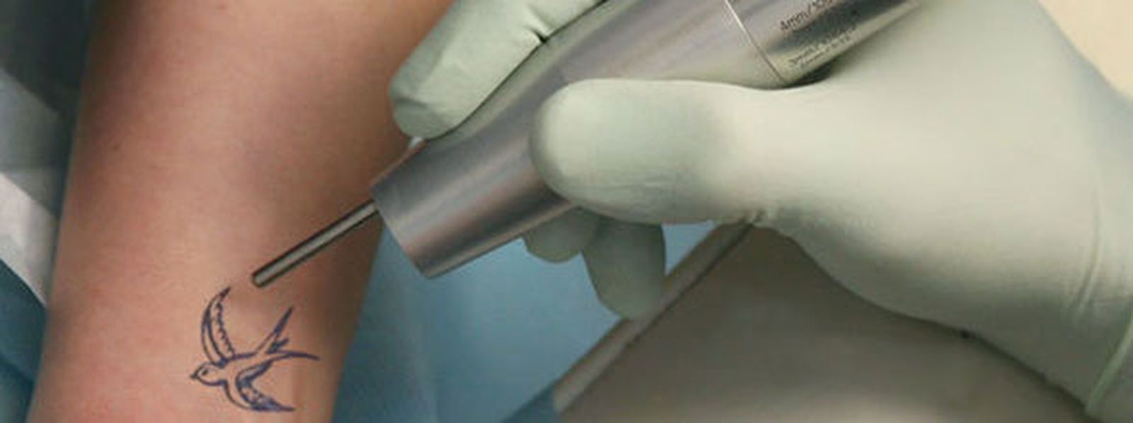 Aquellos que se arrepientan de haber dibujado su piel pueden recurrir al láser para eliminar sus tatuajes. / M. G.