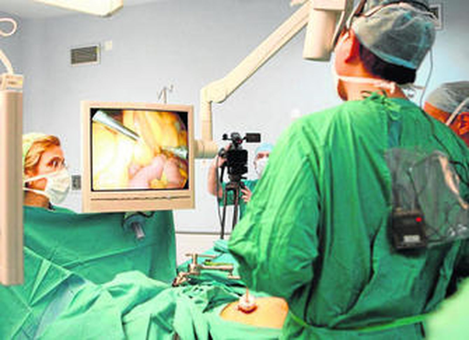 La técnica laparoscópica permite realizar la intervención a través de incisiones muy pequeñas.