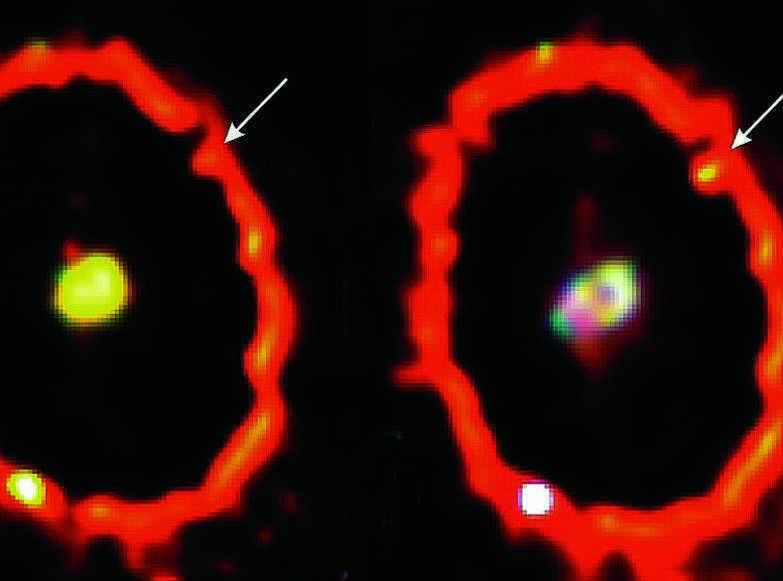 La supernova, a la izquierda como era en 1994. A la derecha, muestra un brillo arriba en la derecha por una colisión de una estrella.