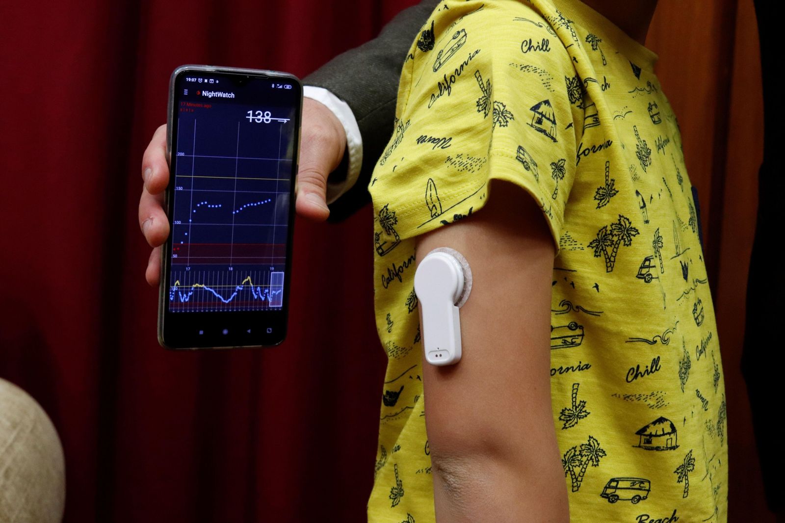 Un dispositivo flash en un menor diabético.